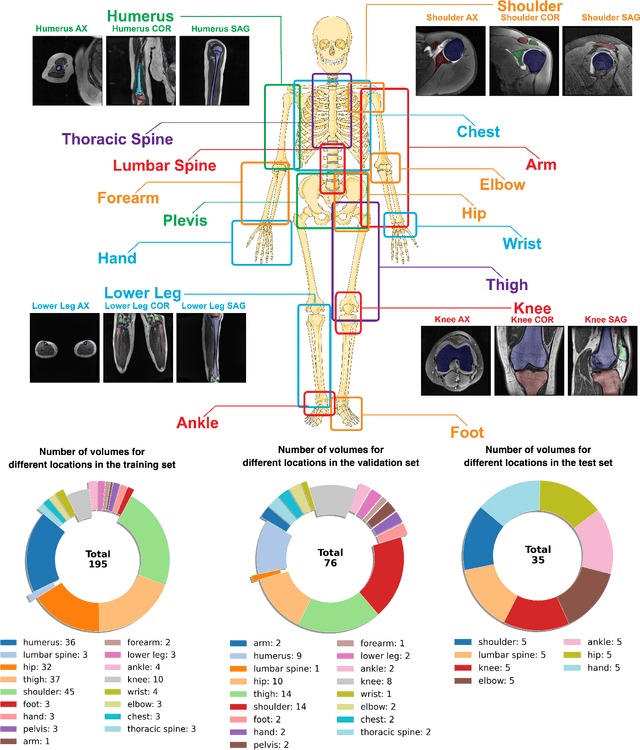 Figure 1 for SegmentAnyBone: A Universal Model that Segments Any Bone at Any Location on MRI