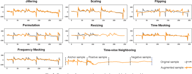 Figure 4 for Guidelines for Augmentation Selection in Contrastive Learning for Time Series Classification