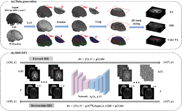 Figure 1 for Diff-DTI: Fast Diffusion Tensor Imaging Using A Feature-Enhanced Joint Diffusion Model