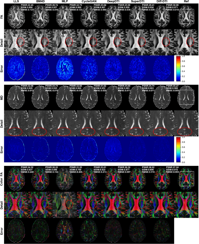 Figure 4 for Diff-DTI: Fast Diffusion Tensor Imaging Using A Feature-Enhanced Joint Diffusion Model