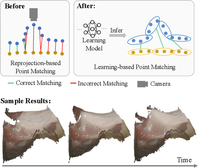 Figure 1 for SuPerPM: A Large Deformation-Robust Surgical Perception Framework Based on Deep Point Matching Learned from Physical Constrained Simulation Data