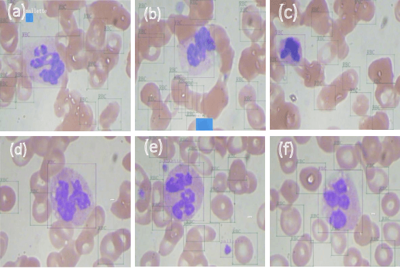 Figure 1 for TXL-PBC: a freely accessible labeled peripheral blood cell dataset
