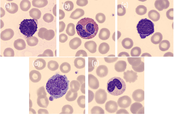 Figure 3 for TXL-PBC: a freely accessible labeled peripheral blood cell dataset