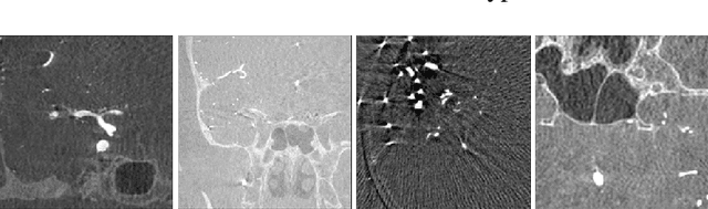 Figure 1 for GS-EMA: Integrating Gradient Surgery Exponential Moving Average with Boundary-Aware Contrastive Learning for Enhanced Domain Generalization in Aneurysm Segmentation