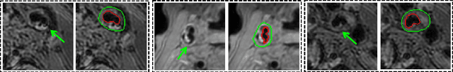 Figure 1 for GAPNet: Granularity Attention Network with Anatomy-Prior-Constraint for Carotid Artery Segmentation