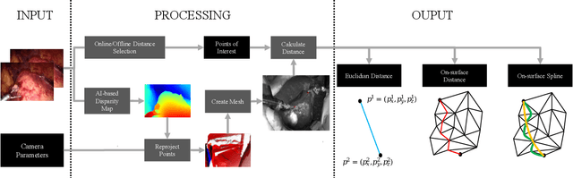 Figure 1 for Redefining the Laparoscopic Spatial Sense: AI-based Intra- and Postoperative Measurement from Stereoimages