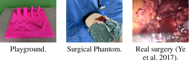 Figure 3 for Redefining the Laparoscopic Spatial Sense: AI-based Intra- and Postoperative Measurement from Stereoimages