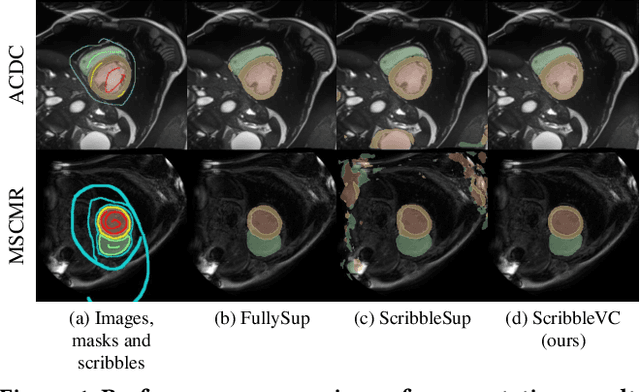 Figure 1 for ScribbleVC: Scribble-supervised Medical Image Segmentation with Vision-Class Embedding