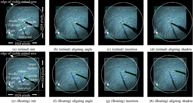 Figure 4 for EyeLS: Shadow-Guided Instrument Landing System for Intraocular Target Approaching in Robotic Eye Surgery