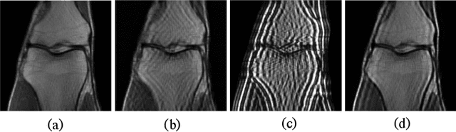 Figure 1 for Robust MRI Reconstruction by Smoothed Unrolling (SMUG)