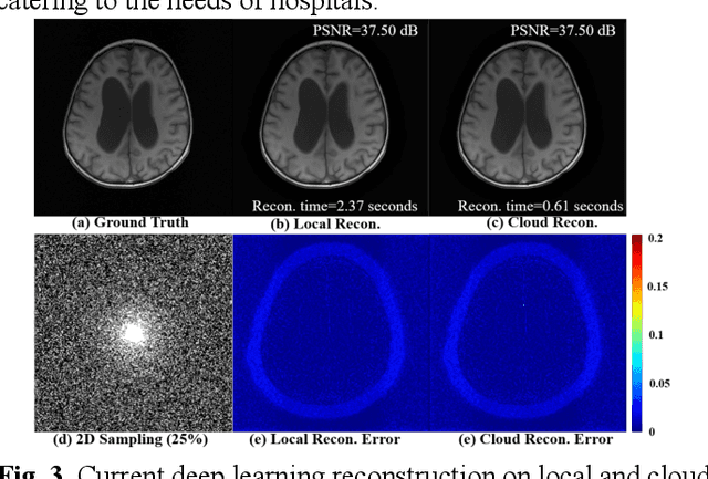 Figure 3 for Cloud-Magnetic Resonance Imaging System: In the Era of 6G and Artificial Intelligence