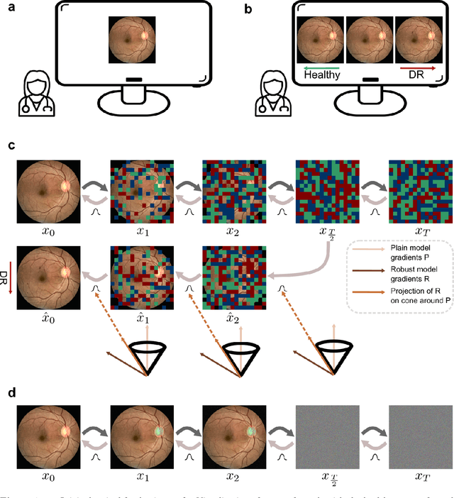 Figure 2 for Generating Realistic Counterfactuals for Retinal Fundus and OCT Images using Diffusion Models