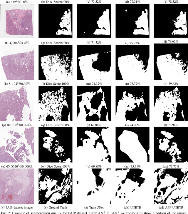 Figure 2 for Adaptive Patching for High-resolution Image Segmentation with Transformers