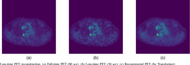 Figure 1 for Whole-body PET image denoising for reduced acquisition time