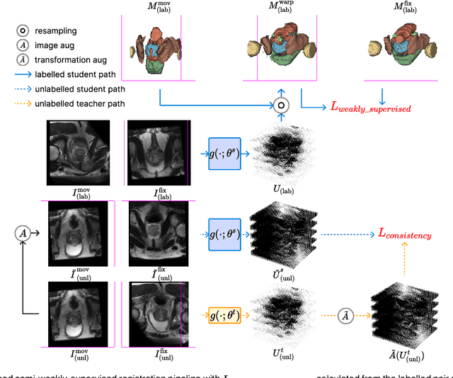Figure 1 for Semi-weakly-supervised neural network training for medical image registration