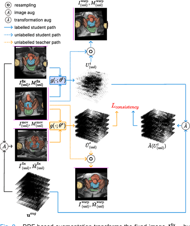 Figure 2 for Semi-weakly-supervised neural network training for medical image registration