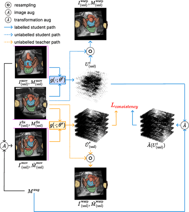 Figure 3 for Semi-weakly-supervised neural network training for medical image registration
