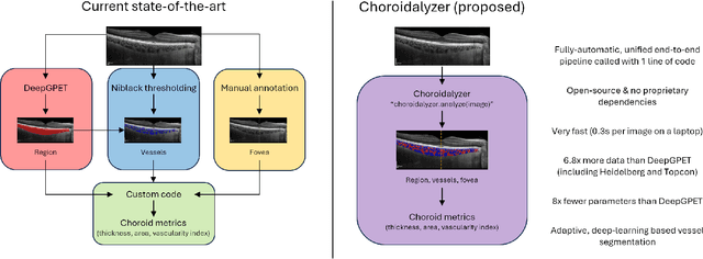 Figure 1 for Choroidalyzer: An open-source, end-to-end pipeline for choroidal analysis in optical coherence tomography