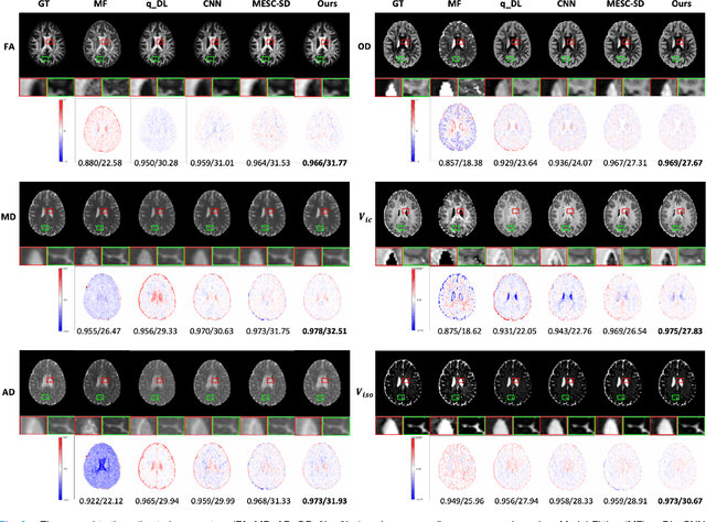 Figure 3 for DeepMpMRI: Tensor-decomposition Regularized Learning for Fast and High-Fidelity Multi-Parametric Microstructural MR Imaging