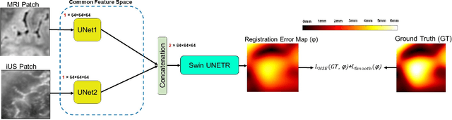 Figure 2 for Dense Error Map Estimation for MRI-Ultrasound Registration in Brain Tumor Surgery Using Swin UNETR