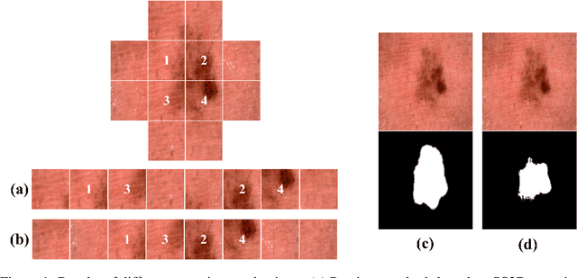 Figure 1 for SliceMamba for Medical Image Segmentation