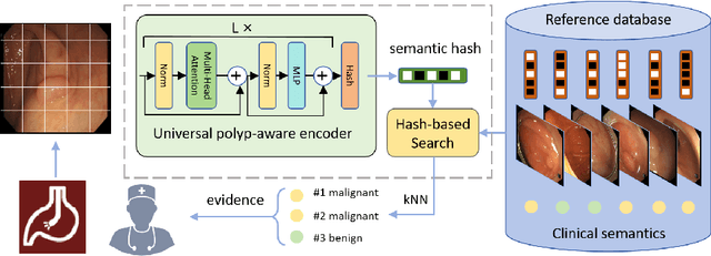 Figure 1 for EndoFinder: Online Image Retrieval for Explainable Colorectal Polyp Diagnosis