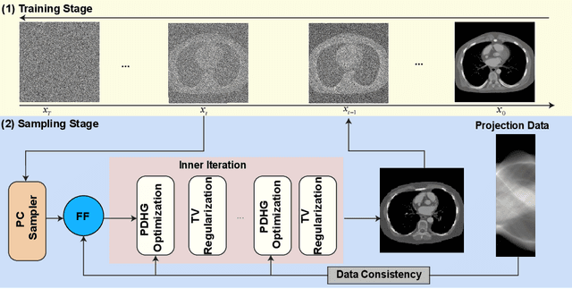 Figure 1 for Physics-informed Score-based Diffusion Model for Limited-angle Reconstruction of Cardiac Computed Tomography