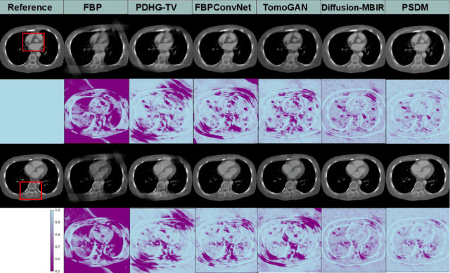 Figure 4 for Physics-informed Score-based Diffusion Model for Limited-angle Reconstruction of Cardiac Computed Tomography