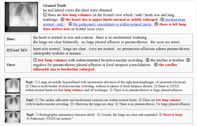 Figure 4 for Enhanced Knowledge Injection for Radiology Report Generation