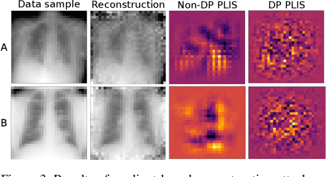 Figure 4 for How Do Input Attributes Impact the Privacy Loss in Differential Privacy?