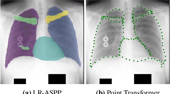 Figure 3 for Combining Image- and Geometric-based Deep Learning for Shape Regression: A Comparison to Pixel-level Methods for Segmentation in Chest X-Ray