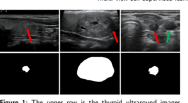 Figure 1 for Thyroid ultrasound diagnosis improvement via multi-view self-supervised learning and two-stage pre-training