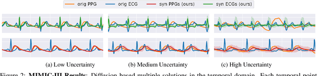 Figure 3 for Uncertainty-Aware PPG-2-ECG for Enhanced Cardiovascular Diagnosis using Diffusion Models