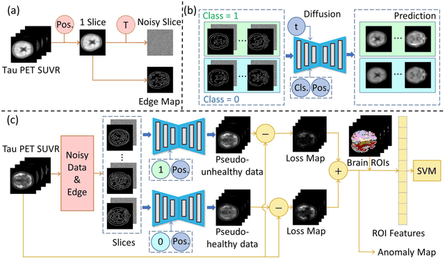 Figure 1 for TauAD: MRI-free Tau Anomaly Detection in PET Imaging via Conditioned Diffusion Models