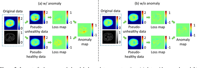 Figure 3 for TauAD: MRI-free Tau Anomaly Detection in PET Imaging via Conditioned Diffusion Models