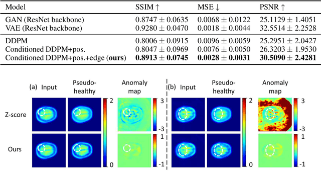 Figure 2 for TauAD: MRI-free Tau Anomaly Detection in PET Imaging via Conditioned Diffusion Models