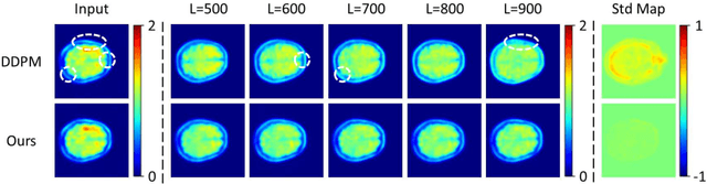 Figure 4 for TauAD: MRI-free Tau Anomaly Detection in PET Imaging via Conditioned Diffusion Models