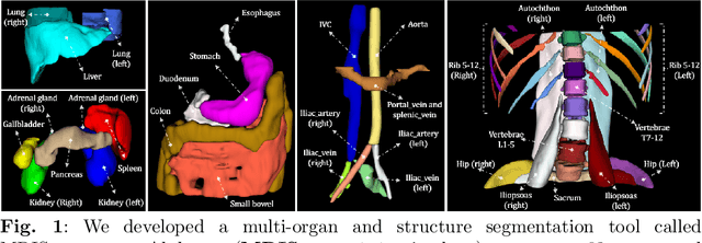 Figure 1 for MRISegmentator-Abdomen: A Fully Automated Multi-Organ and Structure Segmentation Tool for T1-weighted Abdominal MRI