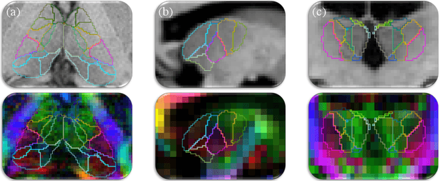 Figure 3 for Domain-agnostic segmentation of thalamic nuclei from joint structural and diffusion MRI