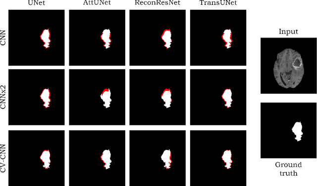 Figure 1 for Complex Network for Complex Problems: A comparative study of CNN and Complex-valued CNN