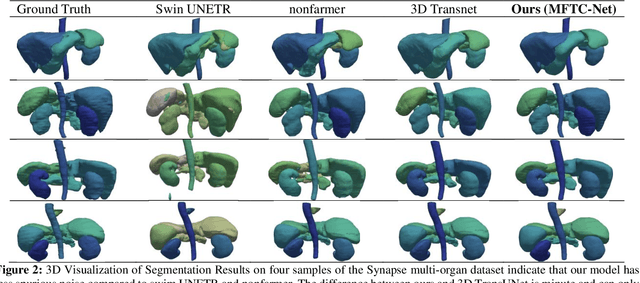 Figure 3 for Multi-Aperture Fusion of Transformer-Convolutional Network (MFTC-Net) for 3D Medical Image Segmentation and Visualization