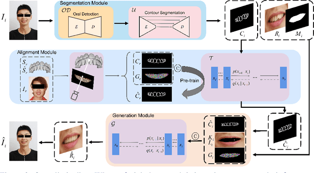 Figure 2 for 3D Structure-guided Network for Tooth Alignment in 2D Photograph