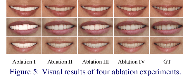 Figure 3 for 3D Structure-guided Network for Tooth Alignment in 2D Photograph