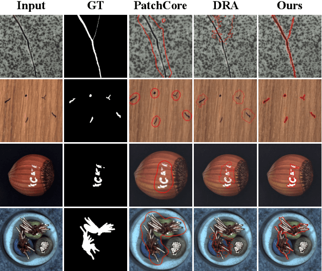 Figure 1 for Prototypical Residual Networks for Anomaly Detection and Localization