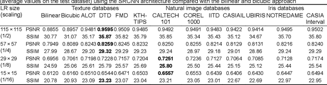 Figure 2 for Iris super-resolution using CNNs: is photo-realism important to iris recognition?