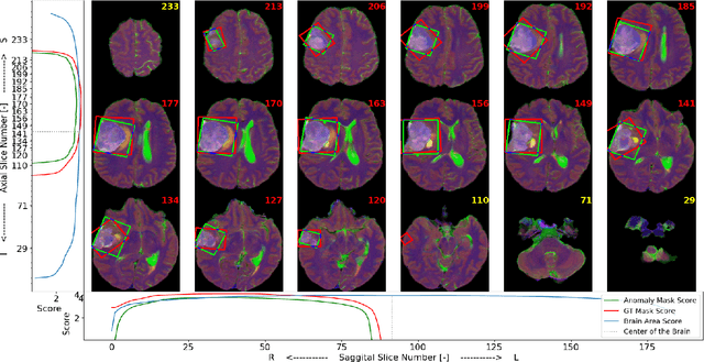 Figure 1 for Brain MRI Screening Tool with Federated Learning