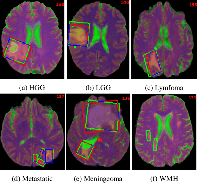 Figure 3 for Brain MRI Screening Tool with Federated Learning