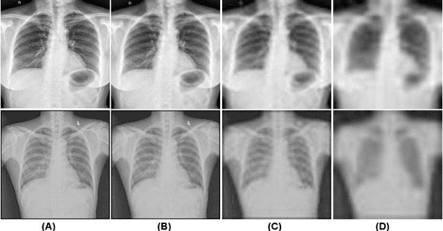 Figure 1 for Low-Resolution Chest X-ray Classification via Knowledge Distillation and Multi-task Learning