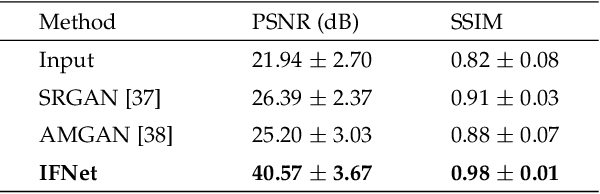 Figure 2 for IFNet: Deep Imaging and Focusing for Handheld SAR with Millimeter-wave Signals