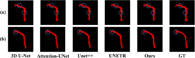 Figure 4 for UADSN: Uncertainty-Aware Dual-Stream Network for Facial Nerve Segmentation